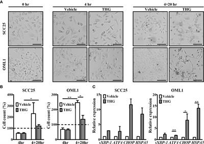 Endoplasmic Reticulum Stress of Oral Squamous Cell Carcinoma Induces Immunosuppression of Neutrophils